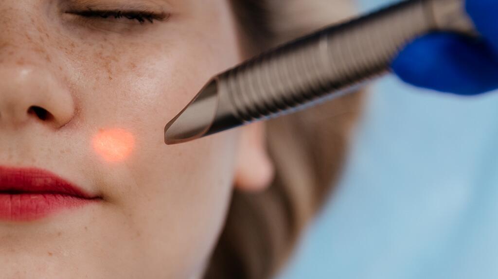 Close-up gezicht, laserbehandeling op de huid.