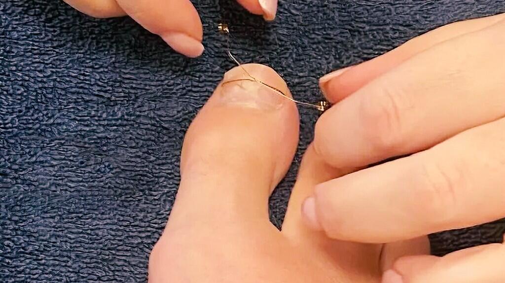 Teennagelverzorging op een blauw oppervlak.
