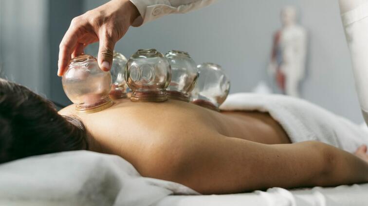 Cuppingtherapie op blote rug in spa, glazen koppen geplaatst.