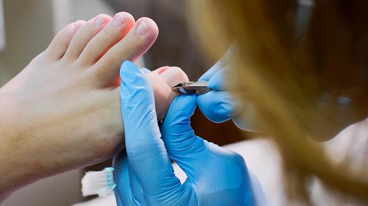 Pedicurebehandeling van een voet, handen dragen blauwe handschoenen.